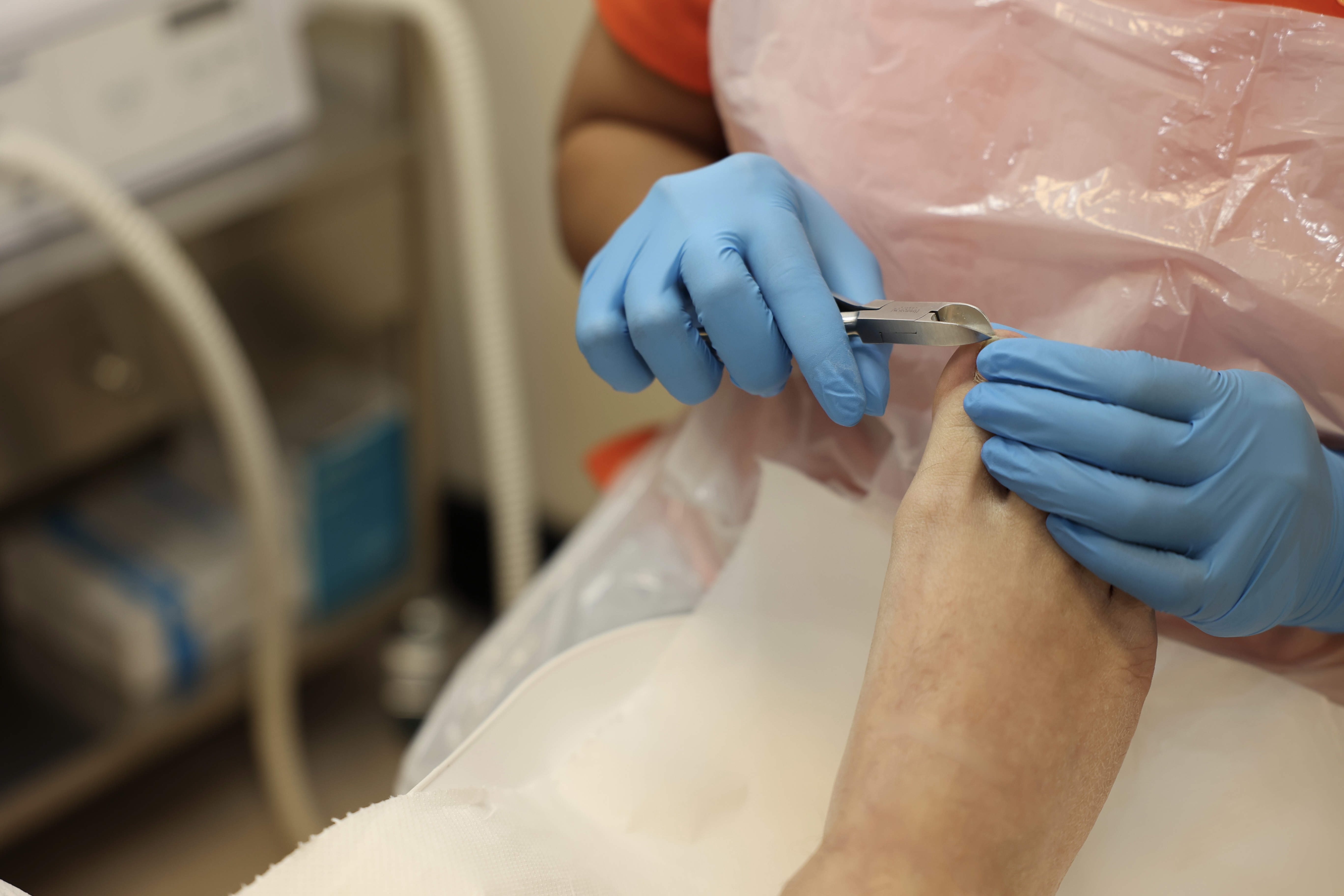 Toenail Surgery Image